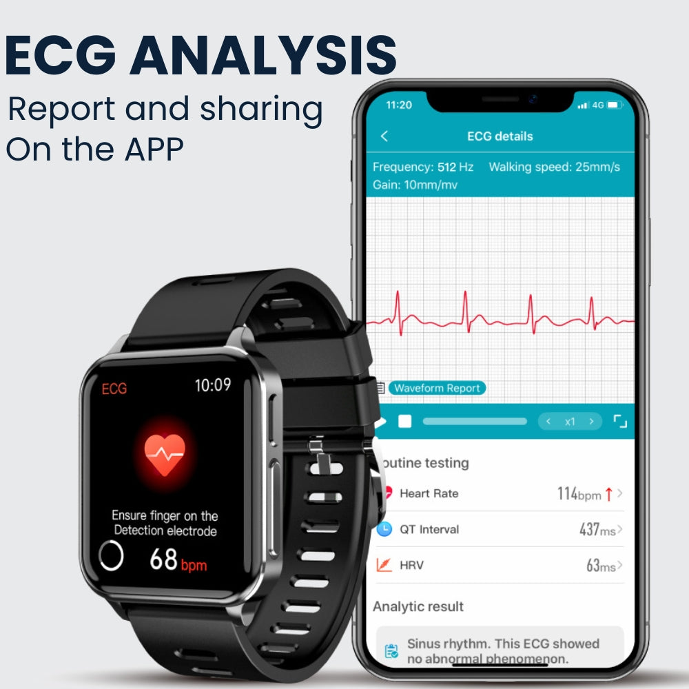 Coxsmart G10 With ECG Heart Rate Blood Oxygen Sleep Monitoring Health SmartWatch